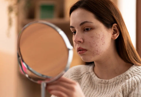 Hyperpigmentation: Causes, Treatments & Skin Care Tips