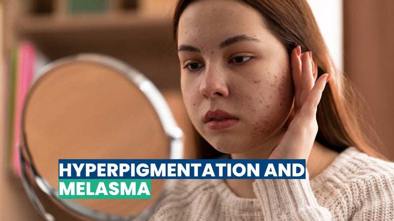 Hyperpigmentation and Melasma | Causes, Types, Prevention & Treatment