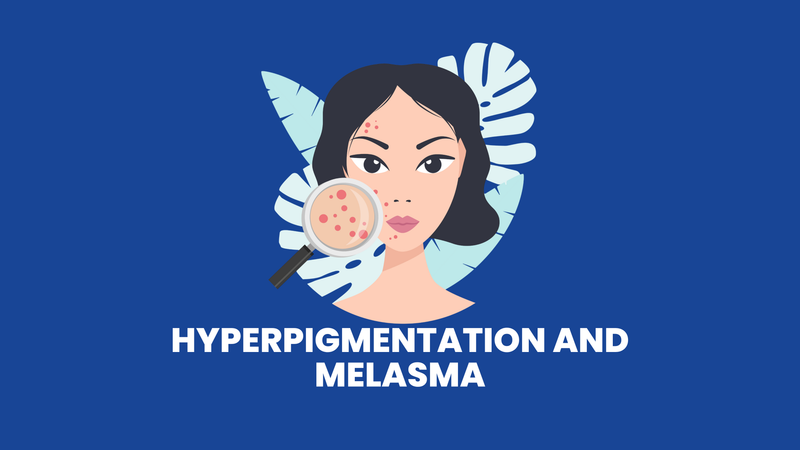 Hyperpigmentation and Melasma | Causes, Types, Prevention & Treatment