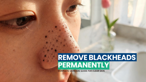 How to Remove Blackheads Permanently | Complete Skincare Guide for Clear Skin