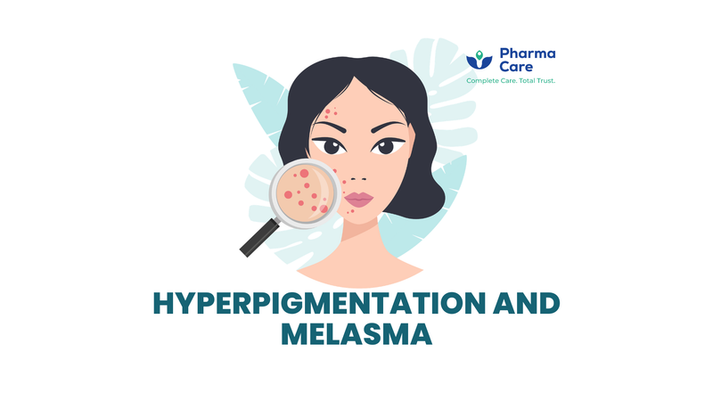Hyperpigmentation and Melasma | Causes, Types, Prevention & Treatment